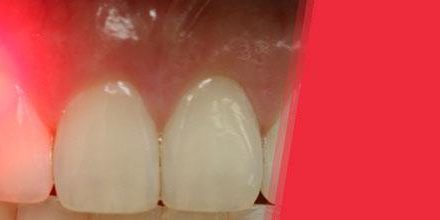 1422294820-laserbanner