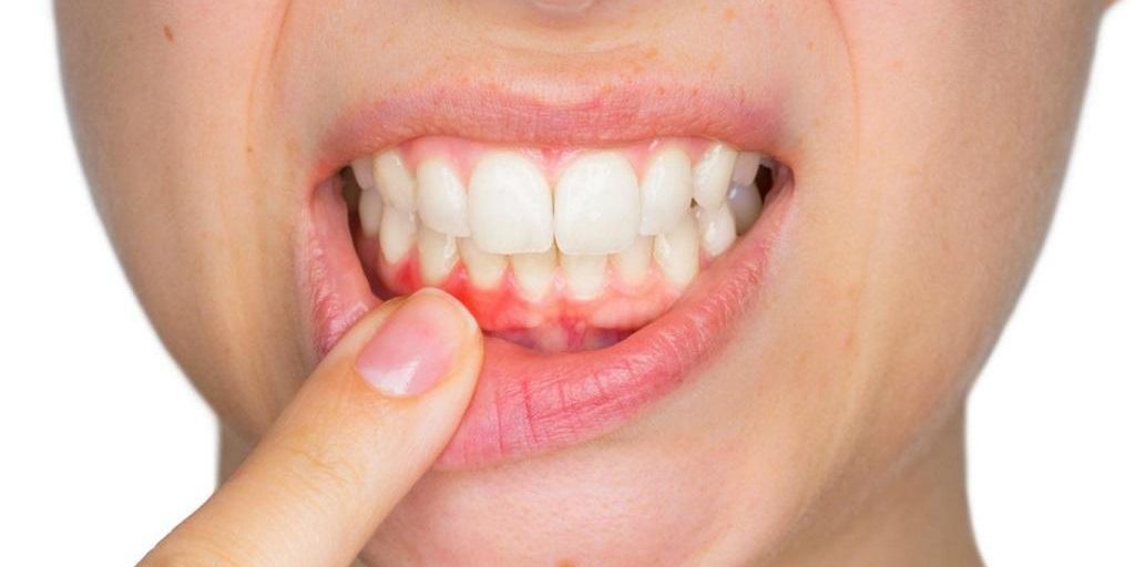 Periodoncia Periodoncia