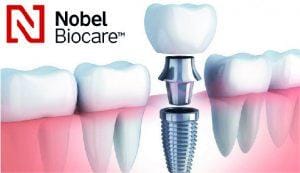 implante dental en una sesion Barcelona Nobel Biocare
