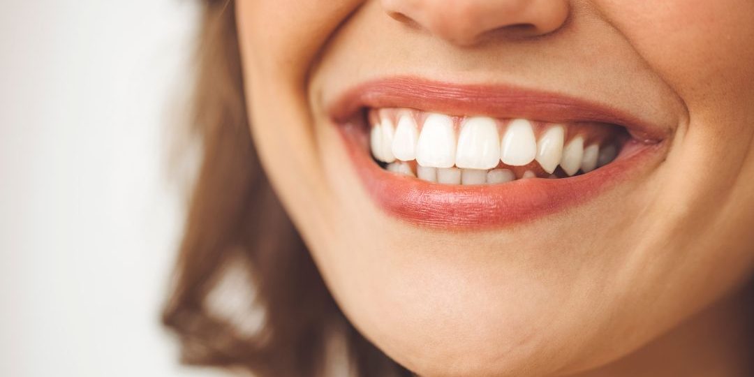 gingivectomia-barcelona-clinica-dental gingivectomia-barcelona-clinica-dental