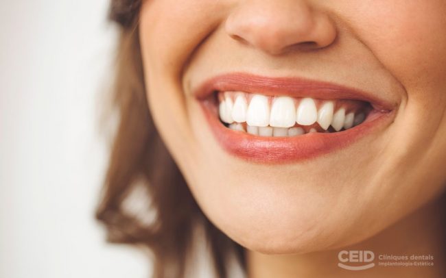 gingivectomia-barcelona-clinica-dental