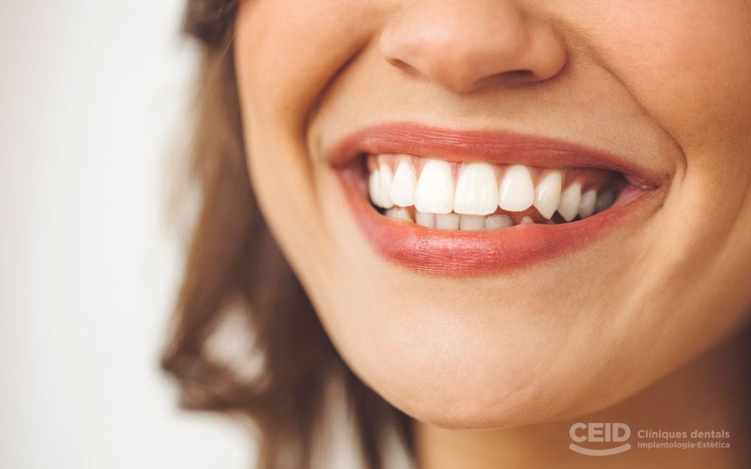 gingivectomia-barcelona-clinica-dental