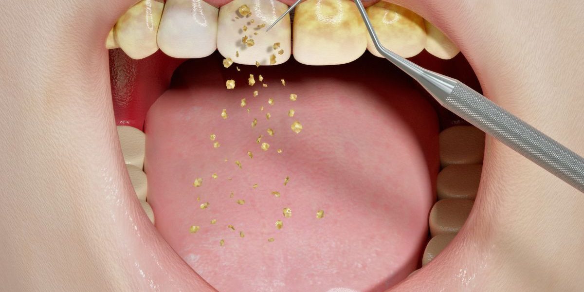 sarro-dental sarro-dental