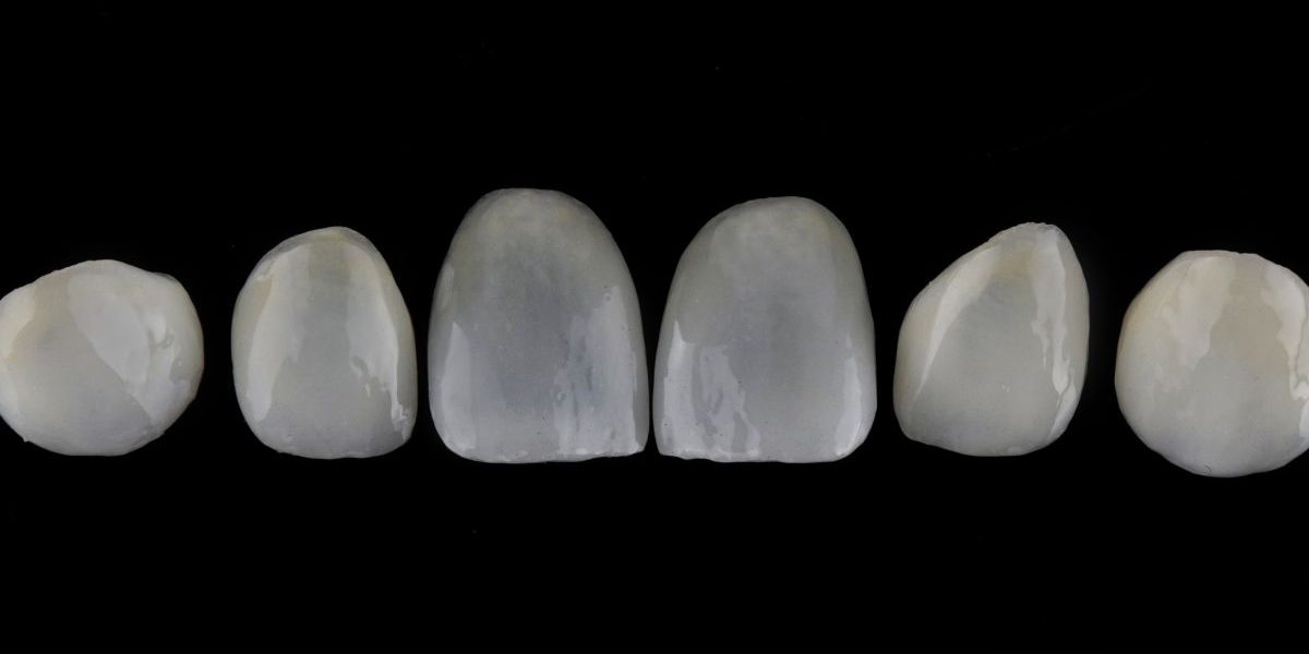 carillas-dentales-sin-tallado-barcelona
