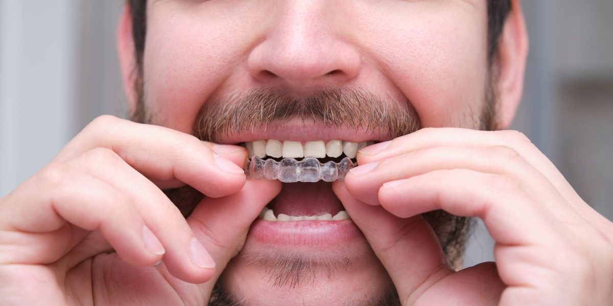 ortodoncia-invisible-resolvemos-tus-dudas ortodoncia-invisible-resolvemos-tus-dudas