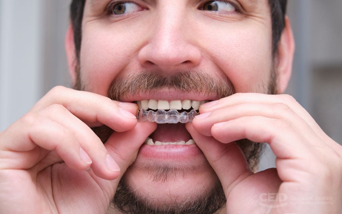 ortodoncia-invisible-resolvemos-tus-dudas
