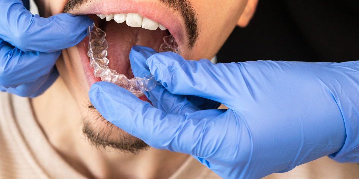 tratamiento-mordida-cruzda-con-ortodoncia-invisible-barcelona