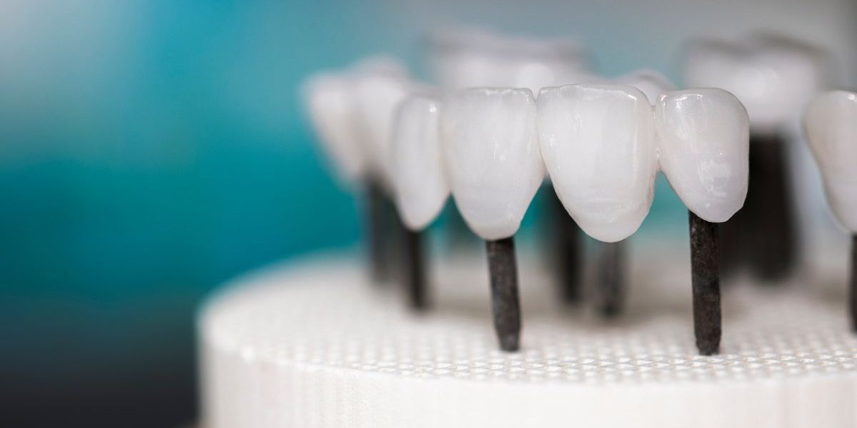 protesis-sobre-implantes-tipos-barcelona protesis-sobre-implantes-tipos-barcelona