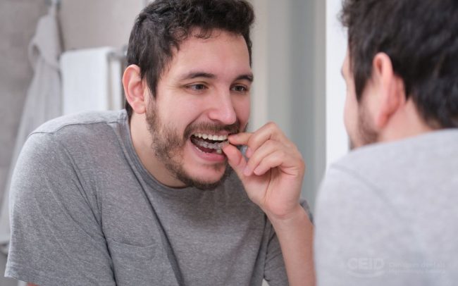 ortodoncia-adultos-barcelona-Clinica-CEID