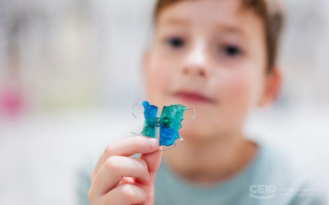 ortodoncia-interceptiva-infantil-barcelona- CEID