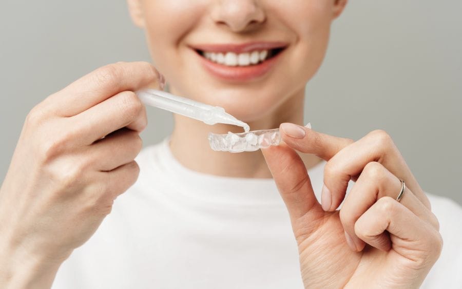 Blanqueamiento Dental en Casa