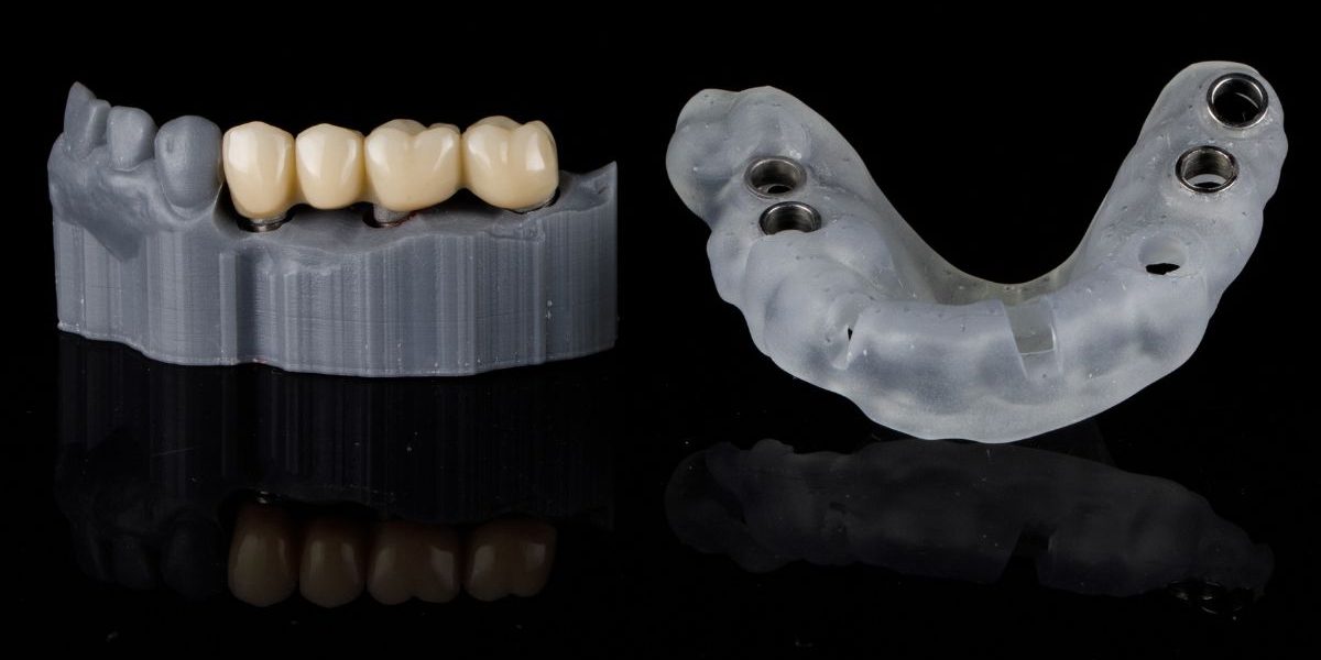 puentes-dentales-barcelona-CEID