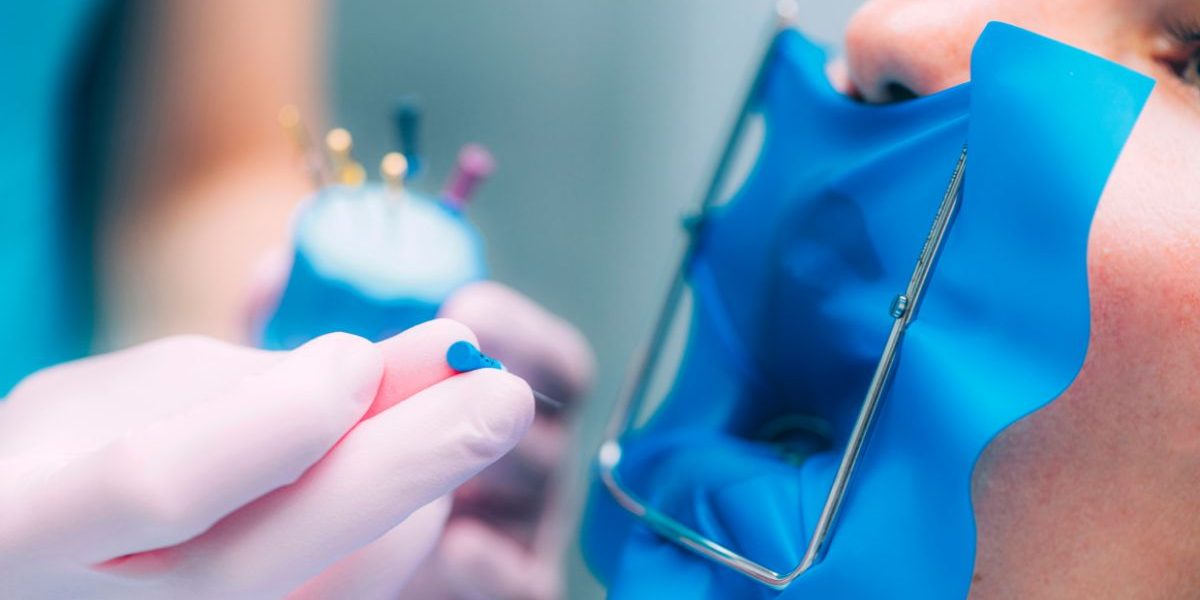 endodoncia-barcelona endodoncia-barcelona