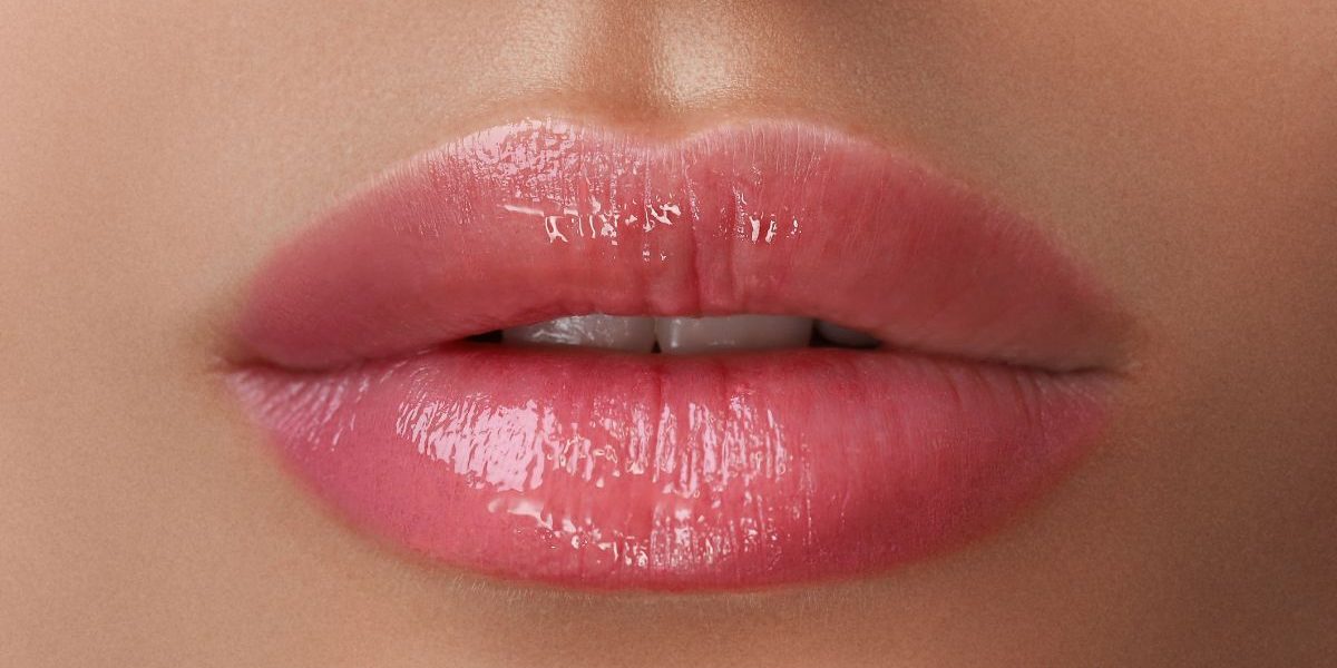 acido-hialurnico-relleno-labios-barcelona acido-hialurnico-relleno-labios-barcelona