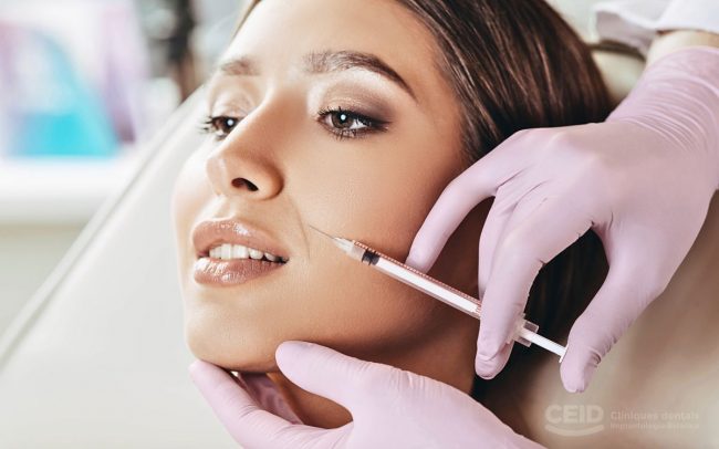 lineas-de-marioneta-tratamiento-barcelona