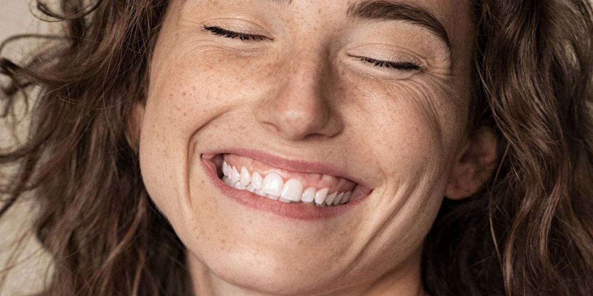 sonrisa-gingival-tratamiento-en-barcelona-ceid sonrisa-gingival-tratamiento-en-barcelona-ceid