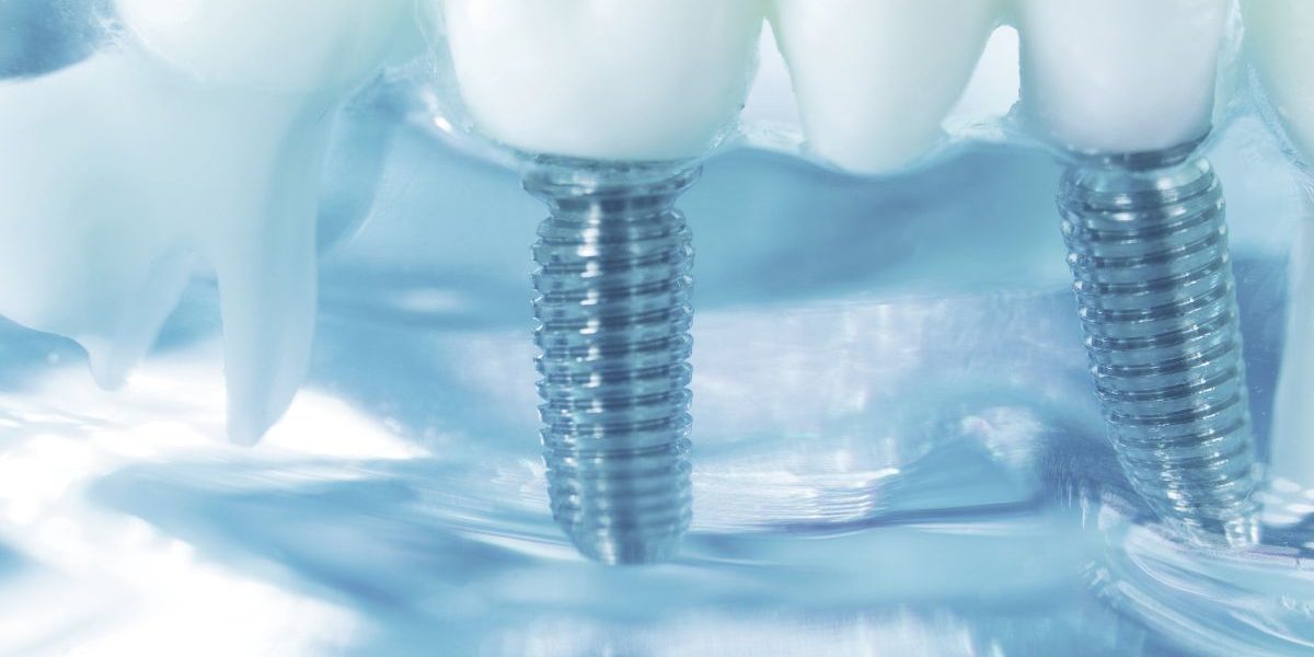 CEID Implantes nobel biocare CEID Implantes nobel biocare