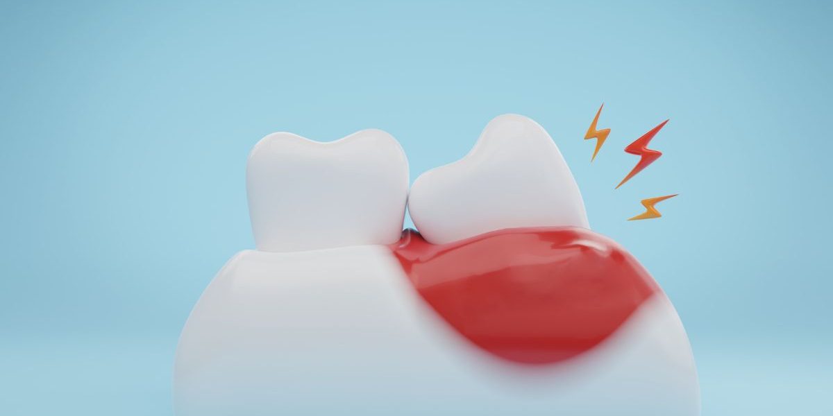 CEID – Encías y corazón Encías y corazón