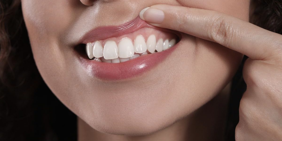 CEID – Por qué retraen las encías Por qué retraen las encías