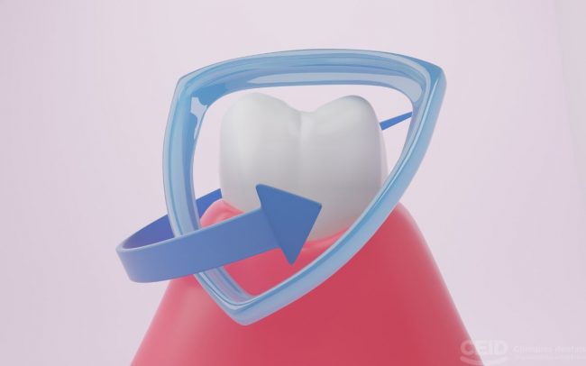 Precio injerto encía