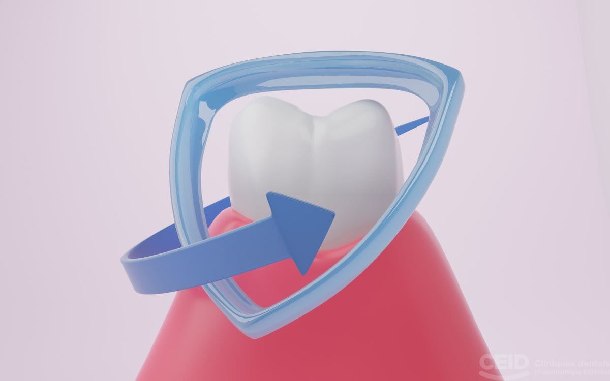 Precio injerto encía