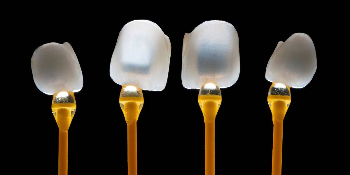 Carillas en 24 horas