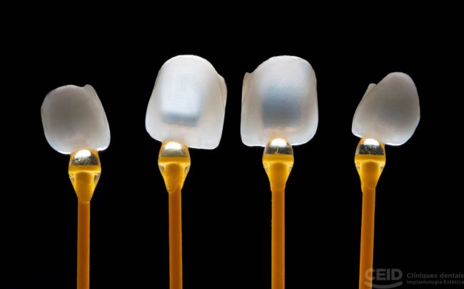 Carillas en 24 horas