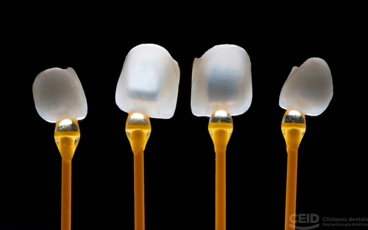 Carillas en 24 horas