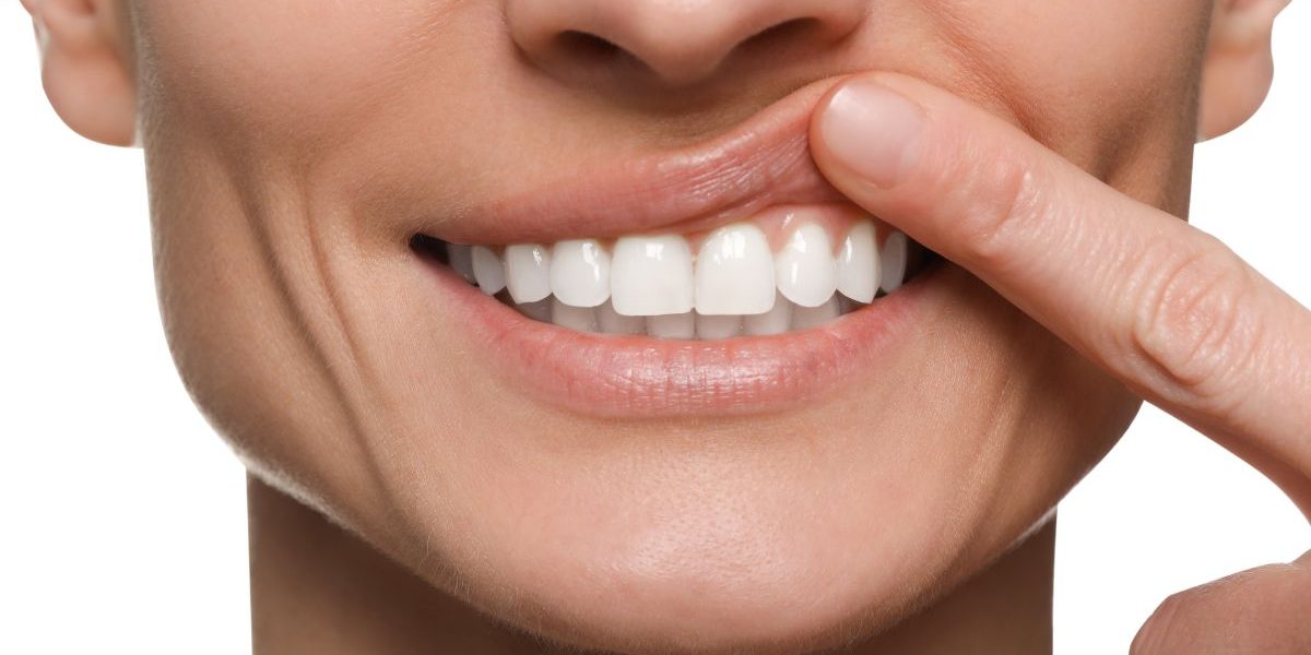 CEID – curetaje periodoncia curetaje periodoncia