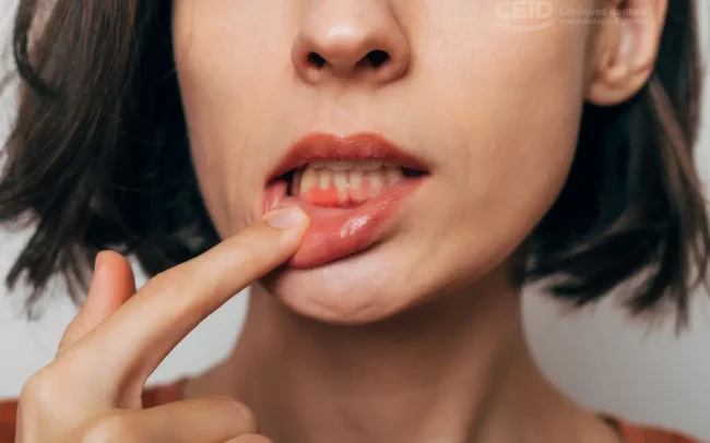 CEID – Opciones para regenerar encías