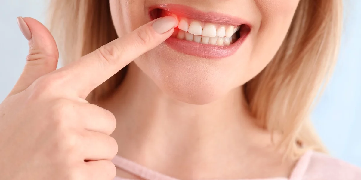 periodontitis y alzheimer