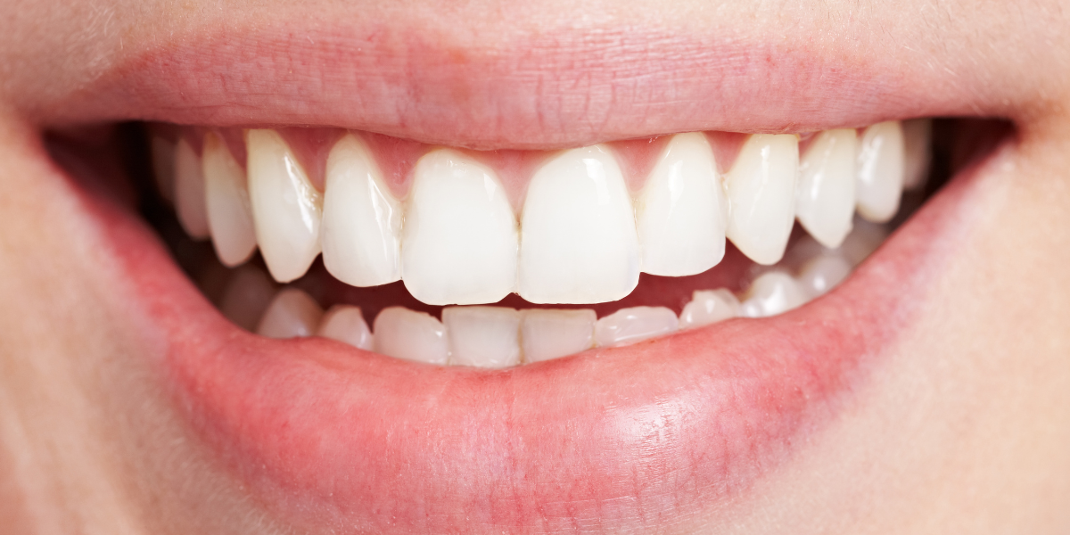 CEID – Apicectomía Apicectomía