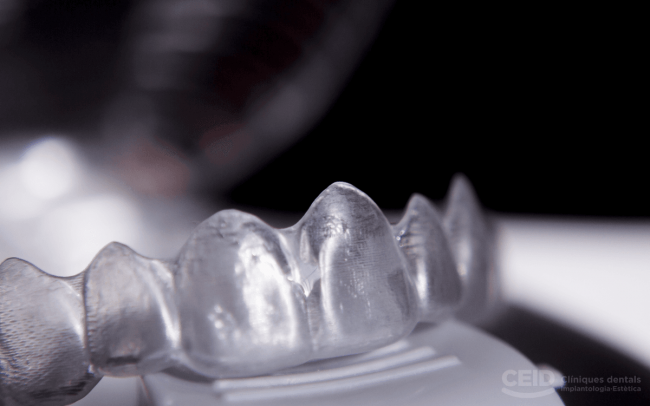 Maloclusiones con Ortodoncia Invisible