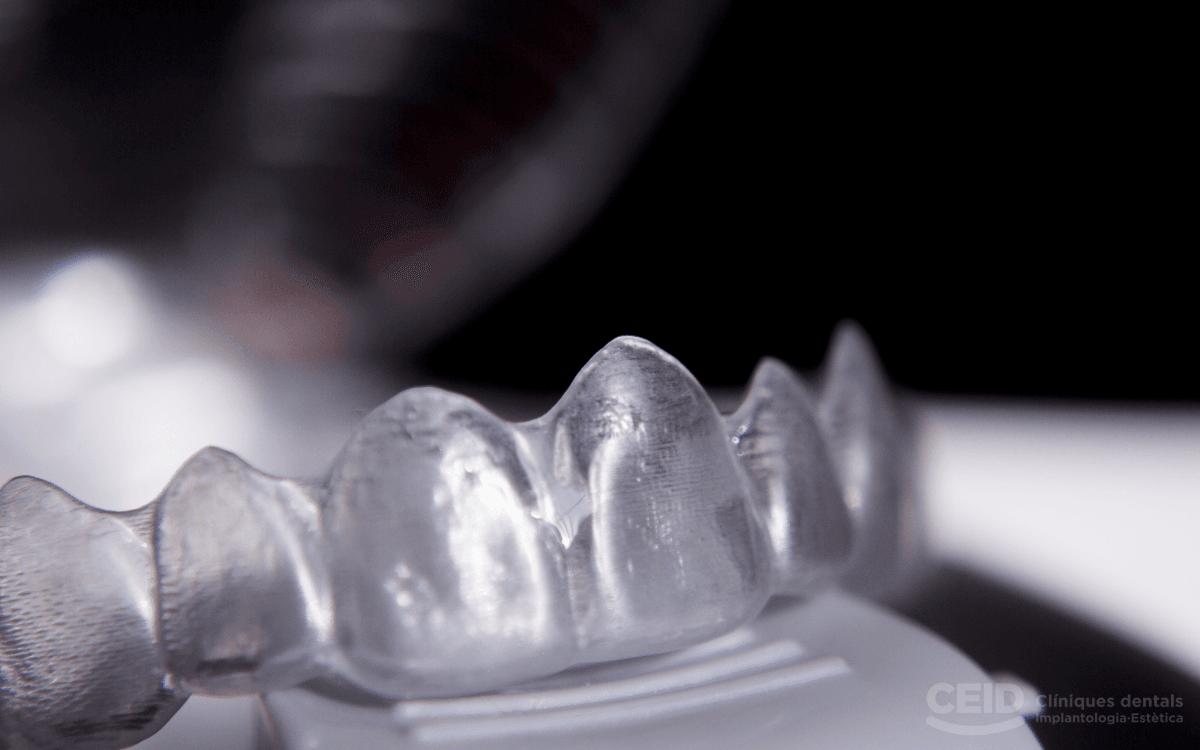 Maloclusiones con Ortodoncia Invisible