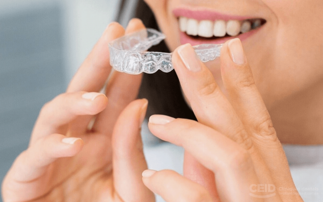 Patologías Invisalign