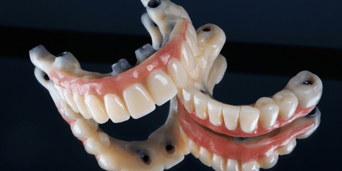 CEID – Reparación de Prótesis Dentales Reparación de Prótesis Dentales