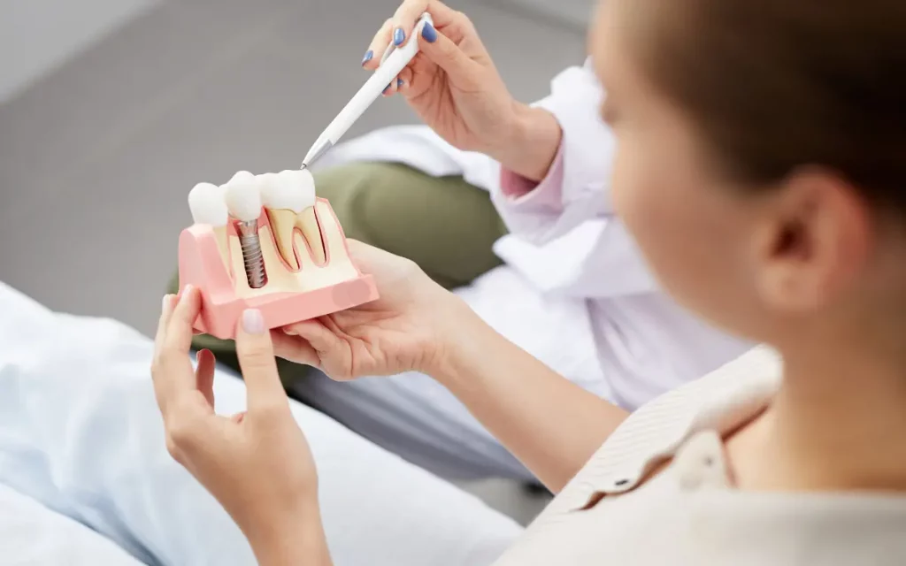 Implantes de carga inmediata en Barcelona para pacientes de fuera