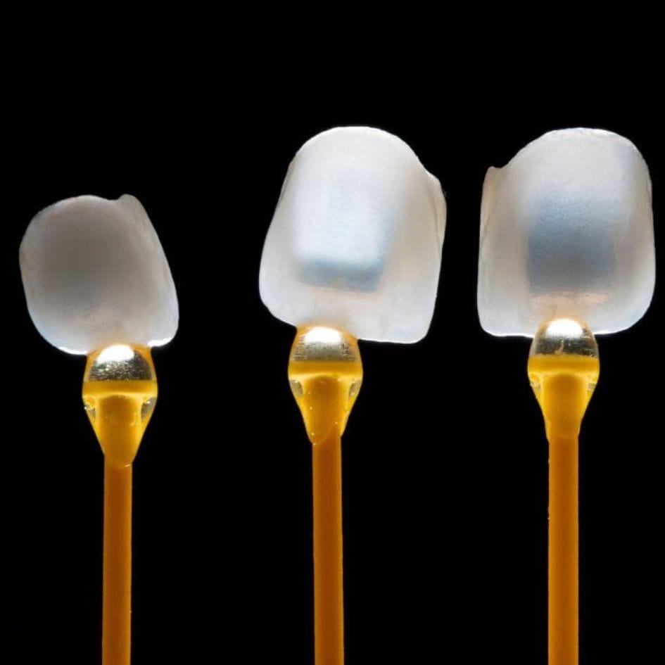 Carillas dentales en CEID Barcelona