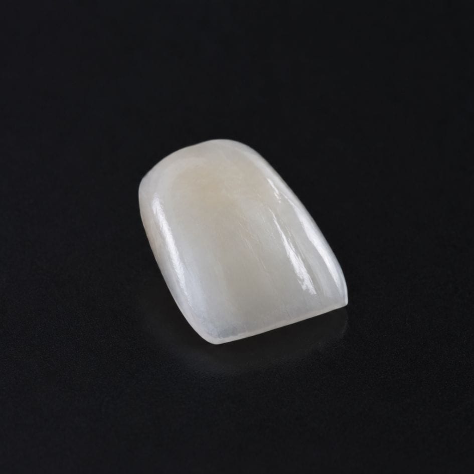 Carillas de porcelana